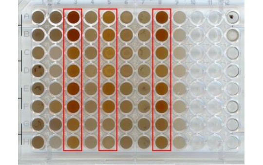 研究人員基于新型顏色測(cè)定法從宏基因組中發(fā)掘酰胺酶，并應(yīng)用于聚氨酯的生物降解